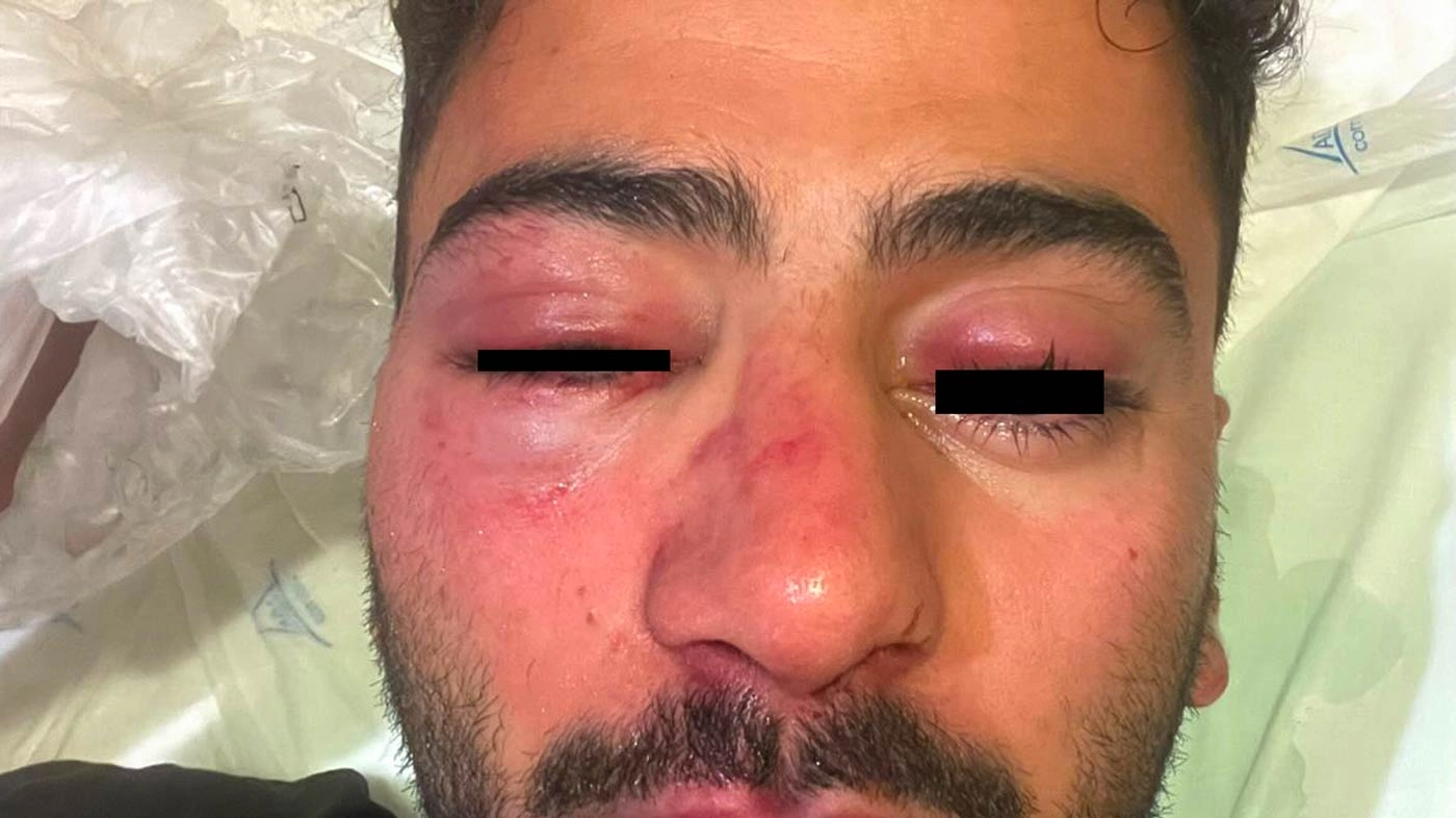 Architecture Student Speaks Out After Brutal Attack in Funchal